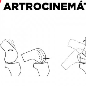 Ligamento cruzado anterior